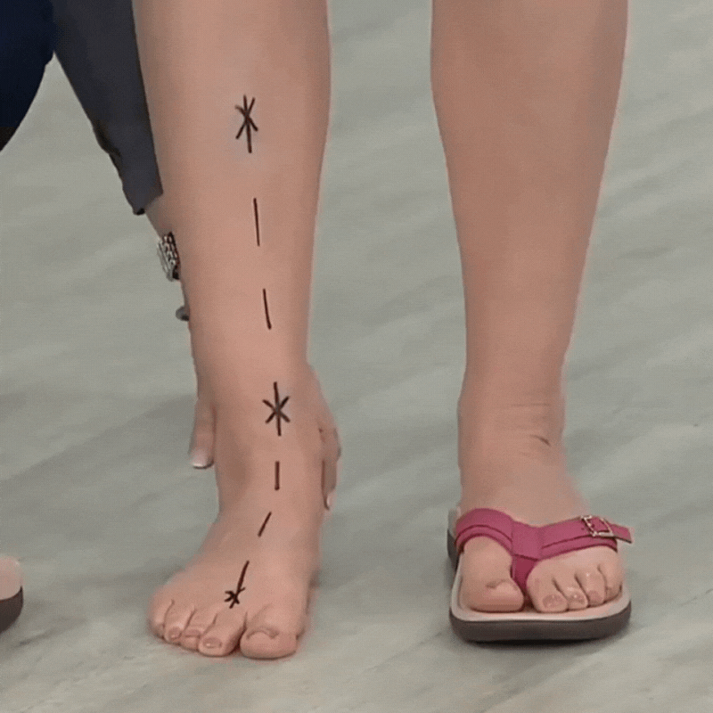Graceful Orthopedic Sandals for Modern Look